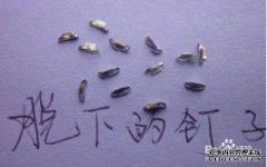 包皮环切手术后会有云南产的白色粉末吗？