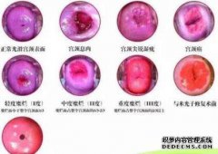 乳白色腹泻怎么办？什么是调理方法？